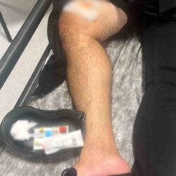 marmariste silahli kavga 1 yarali 7v1EKqaE.jpg