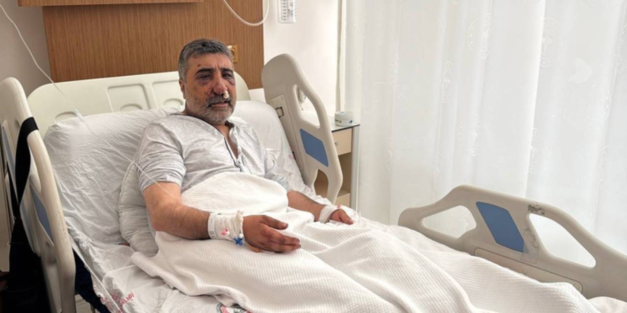 ingiliz boksorun darp ettigi taksicinin davasi goruldu geceleri bagirarak uyaniyorum ezw92aCR.jpg